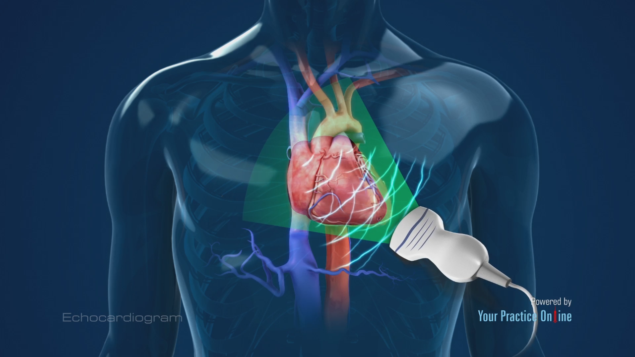 What Is Echo Test For Heart