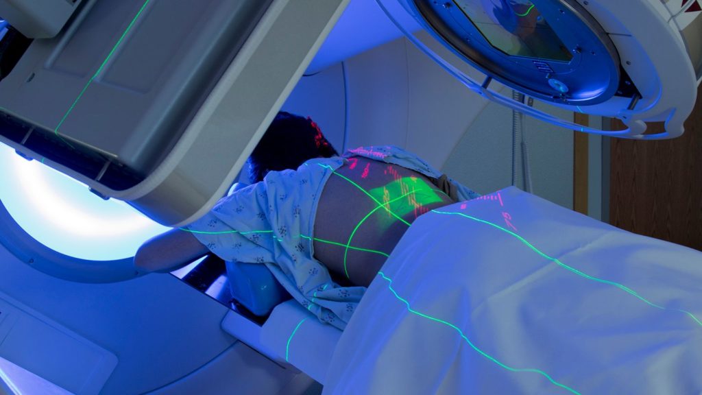 Radiation therapy