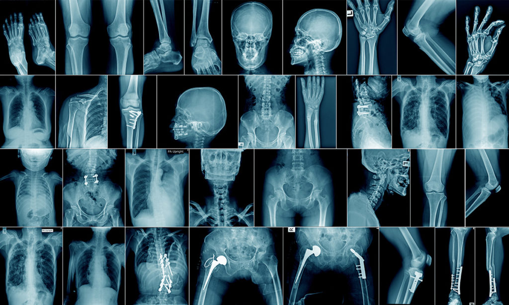 Radiology In A Nutshell: A Comprehensive Guide