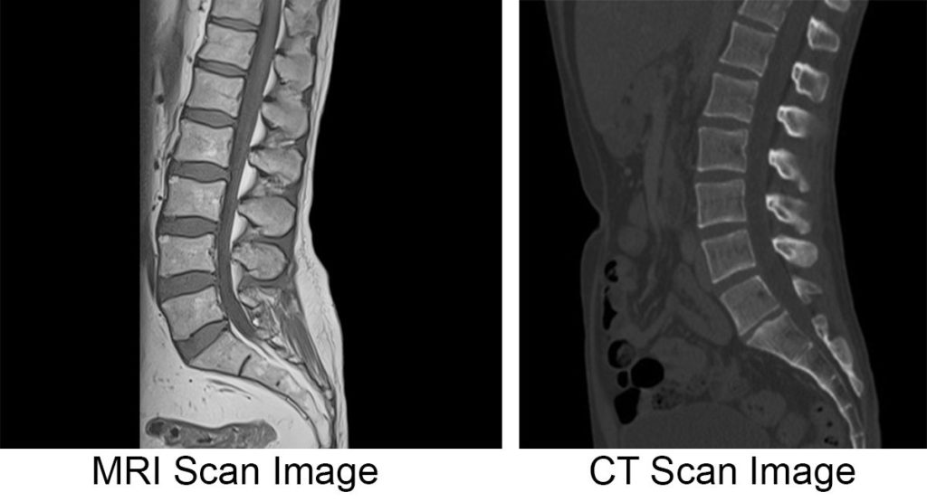 X-RAYS VS CT SCAN