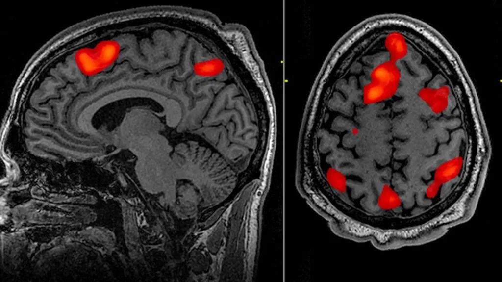 fMRI